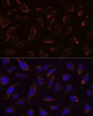 Immunocytochemistry/ Immunofluorescence: Dihydrolipoamide Dehydrogenase/DLD Antibody (3J2O9) [NBP3-16595]