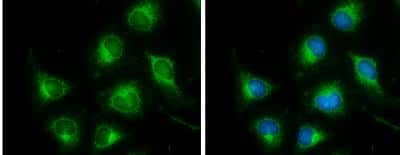 Immunocytochemistry/ Immunofluorescence: Dihydrolipoamide Dehydrogenase/DLD Antibody [NBP1-31302]