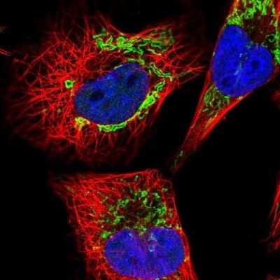 Immunocytochemistry/ Immunofluorescence: Dihydrolipoamide Dehydrogenase/DLD Antibody [NBP2-13926]