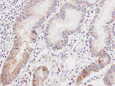 Immunohistochemistry-Paraffin: Dihydrolipoamide Dehydrogenase/DLD Antibody [NBP1-31302]