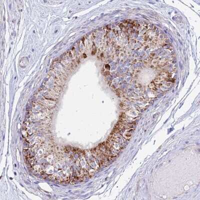 Immunohistochemistry-Paraffin: Dihydrolipoamide Dehydrogenase/DLD Antibody [NBP2-13926]