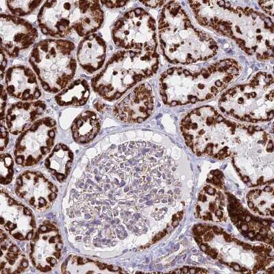 Immunohistochemistry-Paraffin: Dihydrolipoamide Dehydrogenase/DLD Antibody [NBP2-13926]