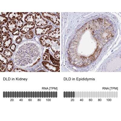 Immunohistochemistry-Paraffin: Dihydrolipoamide Dehydrogenase/DLD Antibody [NBP2-13926]