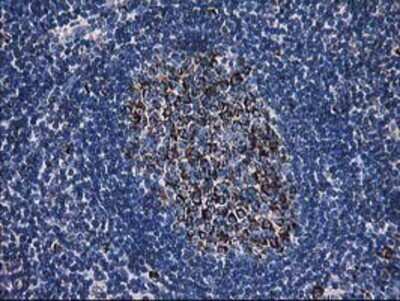 Immunohistochemistry: Dihydrolipoamide Dehydrogenase/DLD Antibody (OTI6D5) - Azide and BSA Free [NBP2-70574]