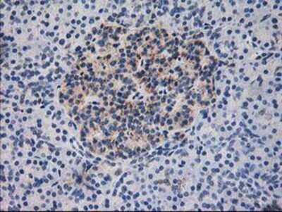 Immunohistochemistry: Dihydrolipoamide Dehydrogenase/DLD Antibody (OTI6D5) - Azide and BSA Free [NBP2-70574]