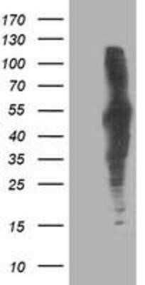 Western Blot: Dihydrolipoamide Dehydrogenase/DLD Antibody (OTI6D5)Azide and BSA Free [NBP2-70574]