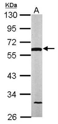 Western Blot: Dihydrolipoamide Dehydrogenase/DLD Antibody [NBP1-31302]