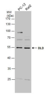 Western Blot: Dihydrolipoamide Dehydrogenase/DLD Antibody [NBP1-31302]