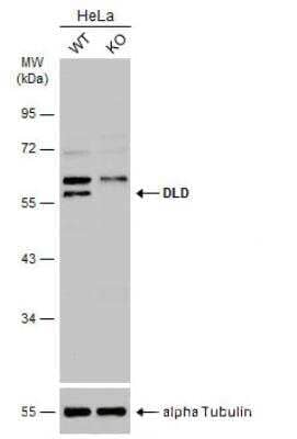 Western Blot: Dihydrolipoamide Dehydrogenase/DLD Antibody [NBP1-31302]