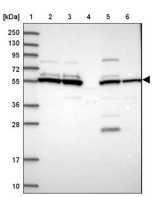Western Blot: Dihydrolipoamide Dehydrogenase/DLD Antibody [NBP2-13926]