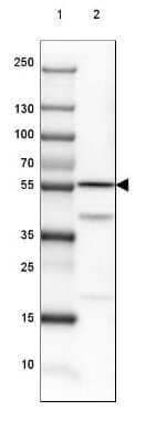 Western Blot: Dihydrolipoamide Dehydrogenase/DLD Antibody [NBP2-13926]