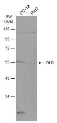 Western Blot: Dihydrolipoamide Dehydrogenase/DLD Antibody [NBP2-19361]
