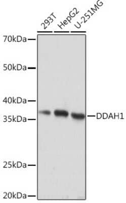 Western Blot: Dimethylarginine Dimethylaminohydrolase 1/DDAH1 Antibody (1Q5F6) [NBP3-16444]