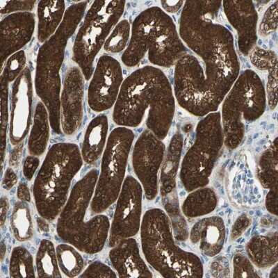 Immunohistochemistry-Paraffin: Dimethylarginine Dimethylaminohydrolase 1/DDAH1 Antibody [NBP1-85273]