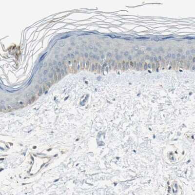 Immunohistochemistry-Paraffin: Dimethylarginine Dimethylaminohydrolase 1/DDAH1 Antibody [NBP1-85273]