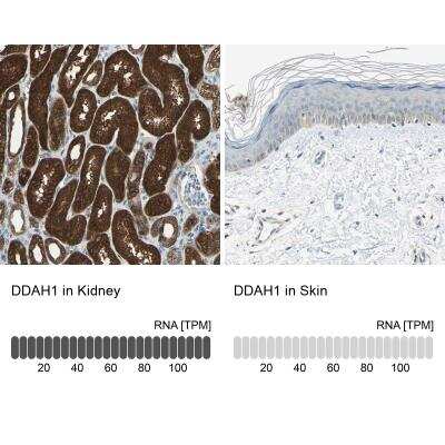 Immunohistochemistry-Paraffin: Dimethylarginine Dimethylaminohydrolase 1/DDAH1 Antibody [NBP1-85273]