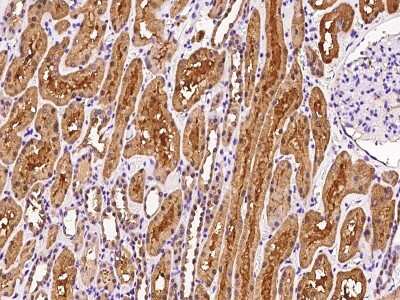 Immunohistochemistry-Paraffin: Dimethylarginine Dimethylaminohydrolase 1/DDAH1 Antibody [NBP2-97531]