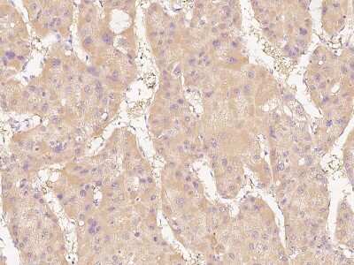 Immunohistochemistry-Paraffin: Dimethylarginine Dimethylaminohydrolase 1/DDAH1 Antibody [NBP2-99138]