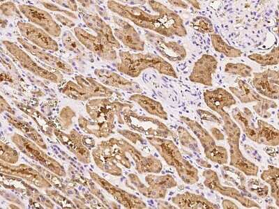 Immunohistochemistry-Paraffin: Dimethylarginine Dimethylaminohydrolase 1/DDAH1 Antibody [NBP2-99138]