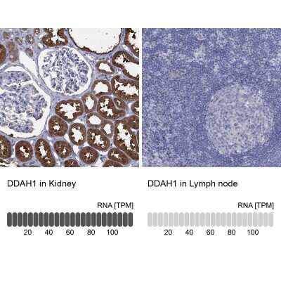 Immunohistochemistry-Paraffin: Dimethylarginine Dimethylaminohydrolase 1/DDAH1 Antibody [NBP3-17013]