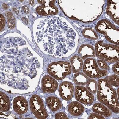 Immunohistochemistry-Paraffin: Dimethylarginine Dimethylaminohydrolase 1/DDAH1 Antibody [NBP3-17013]