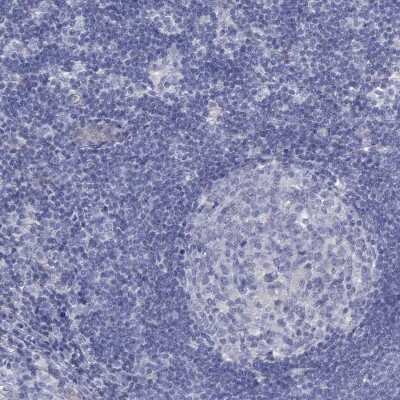 Immunohistochemistry-Paraffin: Dimethylarginine Dimethylaminohydrolase 1/DDAH1 Antibody [NBP3-17013]