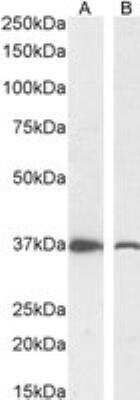 Western Blot: Dimethylarginine Dimethylaminohydrolase 1/DDAH1 Antibody [NB300-916]