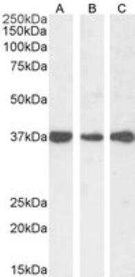 Western Blot: Dimethylarginine Dimethylaminohydrolase 1/DDAH1 Antibody [NB300-916]