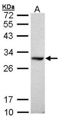 Western Blot: Dimethylarginine Dimethylaminohydrolase 1/DDAH1 Antibody [NBP1-31012]