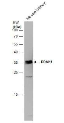 Western Blot: Dimethylarginine Dimethylaminohydrolase 1/DDAH1 Antibody [NBP1-31012]