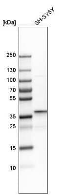Western Blot: Dimethylarginine Dimethylaminohydrolase 1/DDAH1 Antibody [NBP1-85273]