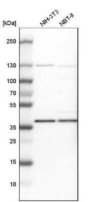 Western Blot: Dimethylarginine Dimethylaminohydrolase 1/DDAH1 Antibody [NBP1-85273]