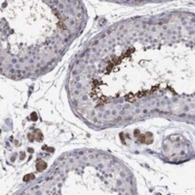 Immunohistochemistry-Paraffin: Dishevelled-1 Antibody [NBP3-17787]