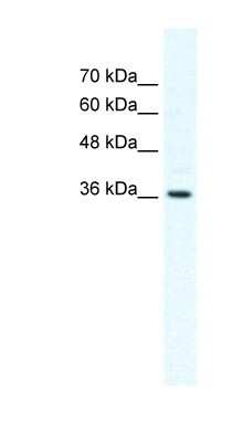 Western Blot: Dishevelled-1 Antibody [NBP1-58317]