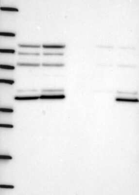 Western Blot: Dishevelled-1 Antibody [NBP3-17787]