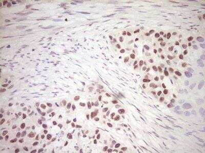 Immunohistochemistry-Paraffin: Dishevelled-2 Antibody (OTI2D11) [NBP2-46480]