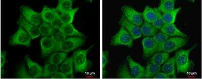 Immunocytochemistry/ Immunofluorescence: Dishevelled-2 Antibody [NBP2-16168]