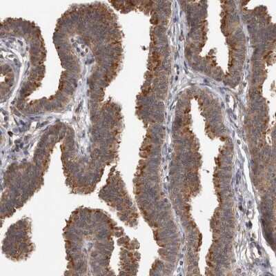Immunohistochemistry-Paraffin: Dishevelled-2 Antibody [NBP1-87550]