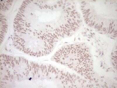 Immunohistochemistry: Dishevelled-2 Antibody (OTI2D11) - Azide and BSA Free [NBP2-70611]