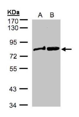 Western Blot: Dishevelled-2 Antibody [NBP1-32388]