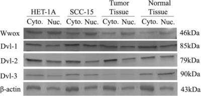 Western Blot: Dishevelled-2 Antibody [NBP1-32388]