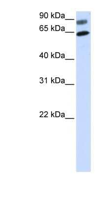 Western Blot: Dishevelled-2 Antibody [NBP1-58849]