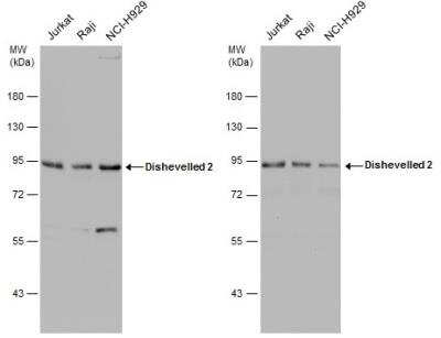 Western Blot: Dishevelled-2 Antibody [NBP2-16168]