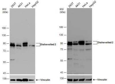 Western Blot: Dishevelled-2 Antibody [NBP2-16168]