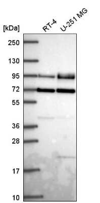 Western Blot: Dishevelled-2 Antibody [NBP2-56345]