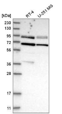 Western Blot: Dishevelled-2 Antibody [NBP2-58480]