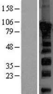 Western Blot: Dishevelled-2 Overexpression Lysate [NBL1-10063]