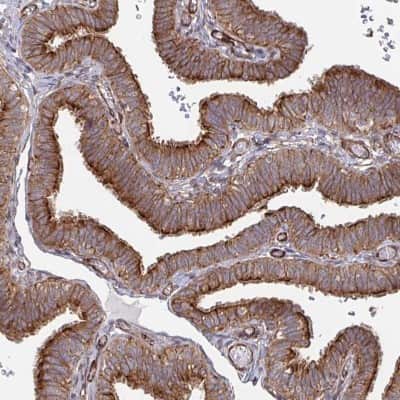 Immunohistochemistry-Paraffin: Dishevelled-3 Antibody [NBP2-38846]
