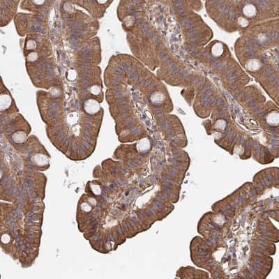 Immunohistochemistry-Paraffin: Dishevelled-3 Antibody [NBP2-38846]