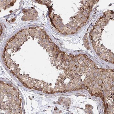 Immunohistochemistry-Paraffin: Dishevelled-3 Antibody [NBP2-38846]
